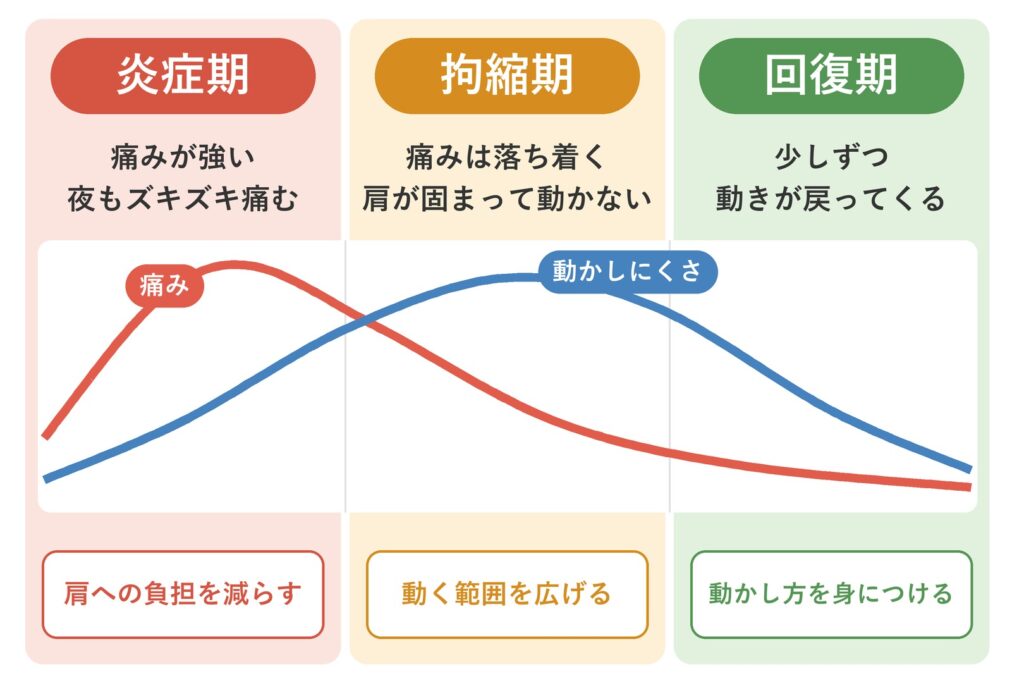五十肩の3つの時期（炎症期・拘縮期・回復期）