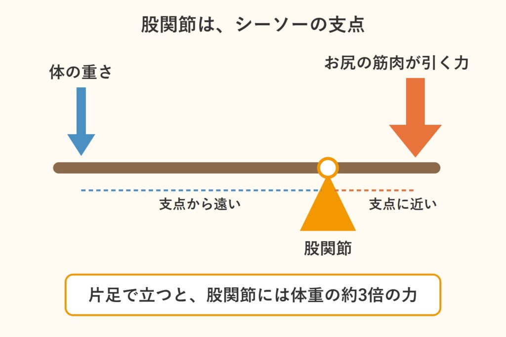股関節はシーソーの支点。片足で立つと体重の約3倍の力がかかる